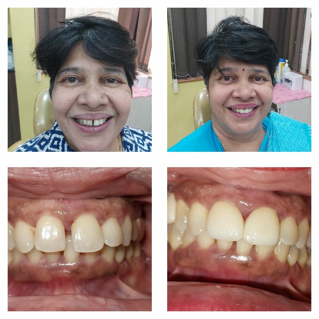 Unique children's clinic and Dental Implant Center|Karvenagar,Pune